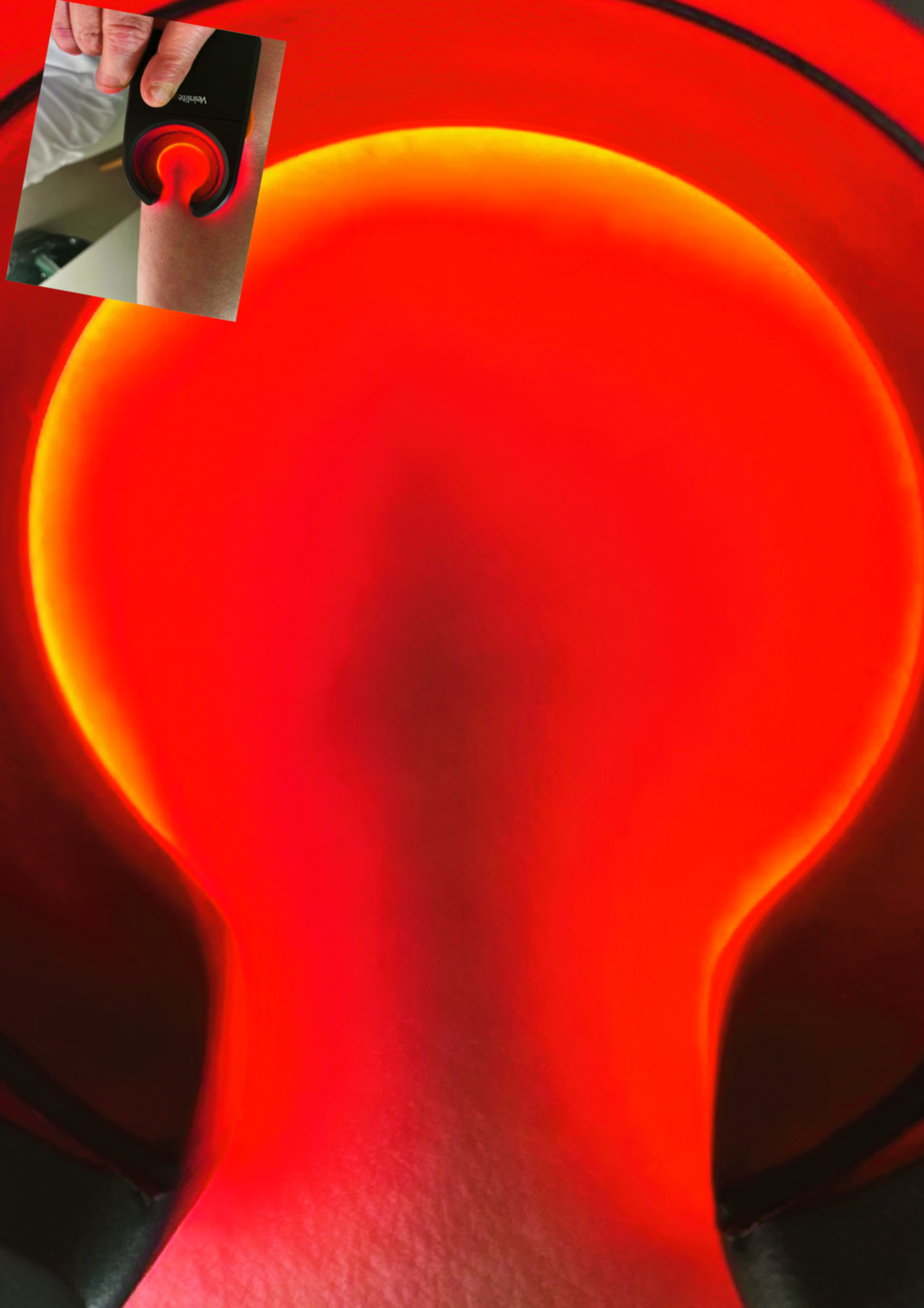 Lampe vasculaire 2025